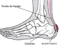 Calcanhar de Aquiles